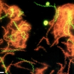 Microphotographie de Spirochaeta americana rendue fluorescente. Les formes spiralées rouge sont des cellules mortes, les vertes sont en vie.