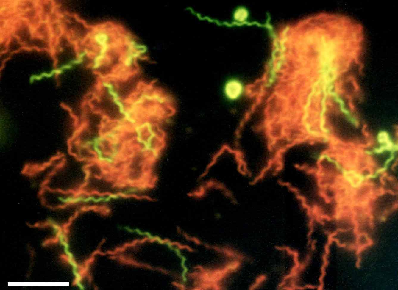 Microphotographie de Spirochaeta americana rendue fluorescente. Les formes spiralées rouge sont des cellules mortes, les vertes sont en vie.