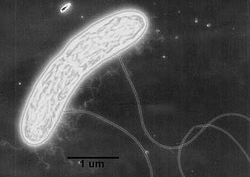 Microphotographie de Geobacter metallidreducens